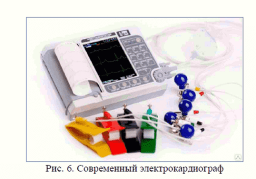 Регистрация электрокардиограммы 