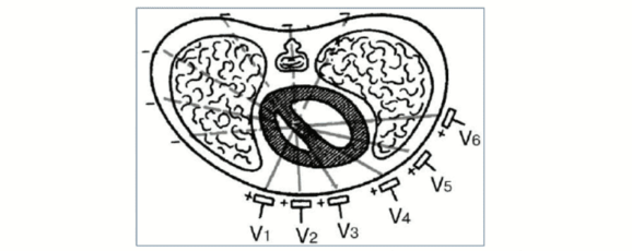 Расположение осей 6-ти грудных отведений в горизонтальной плоскости