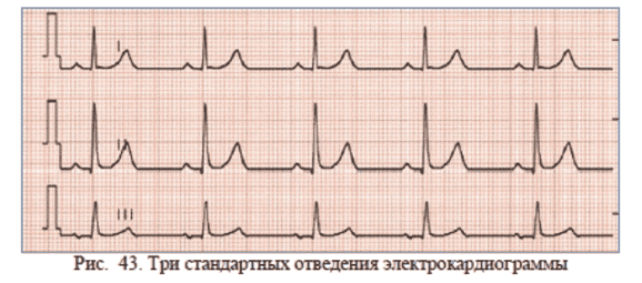 Подсчёт числа сердечных сокращений