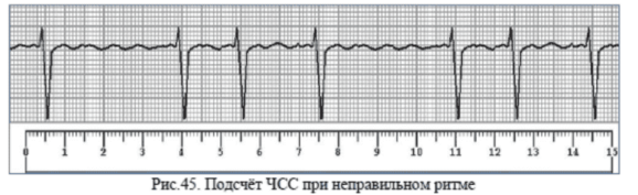 Подсчёт числа сердечных сокращений