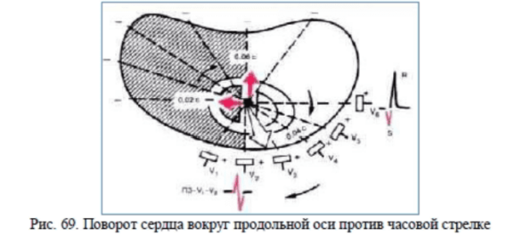 Определение поворотов сердца вокруг продольной оси