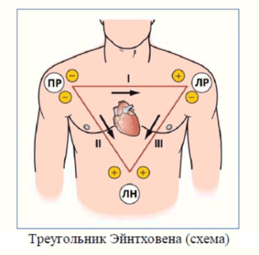 Треугольник Эйнтховена